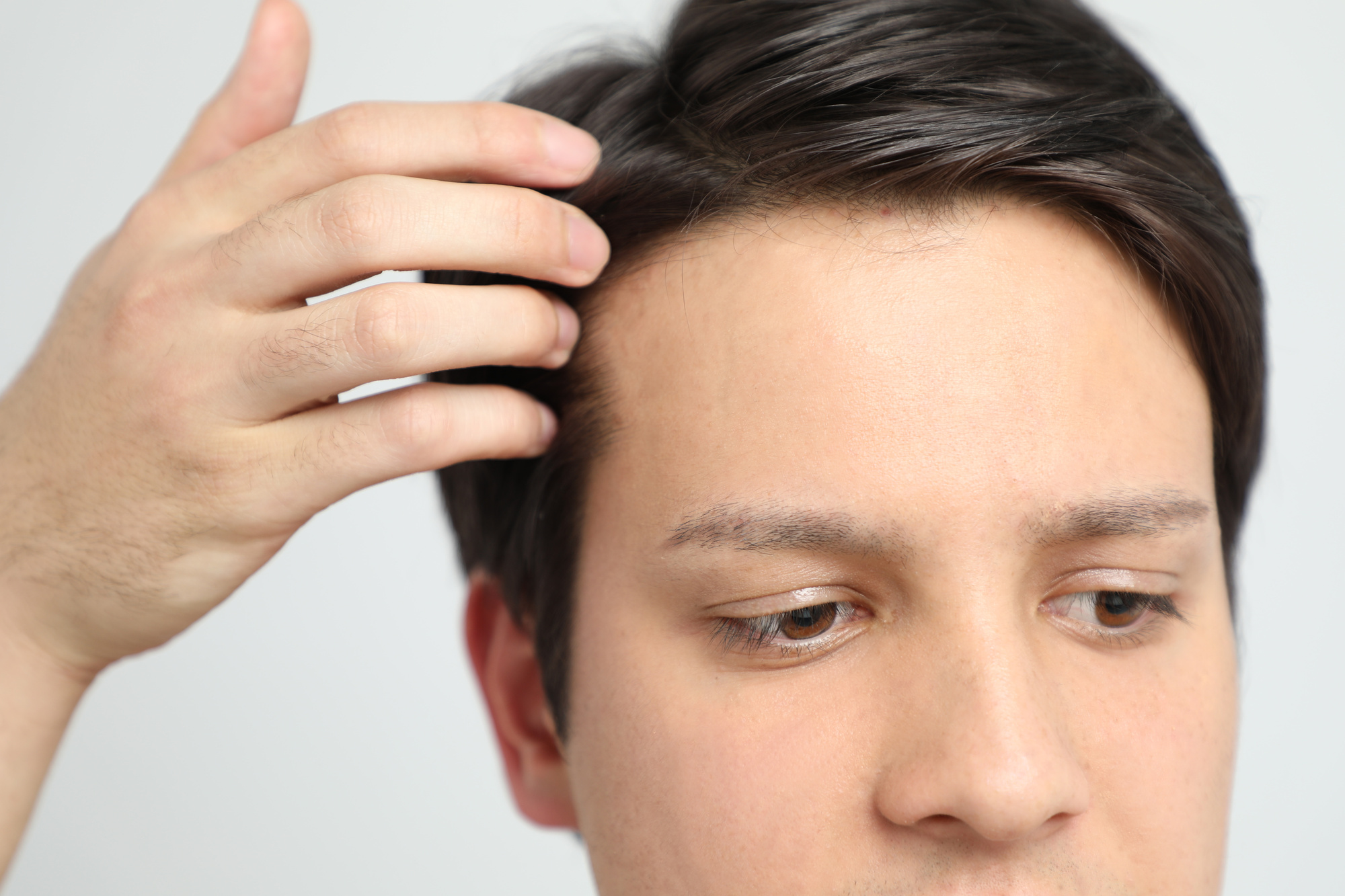 How Long Does A Hair Transplant Last? | FUE Clinics